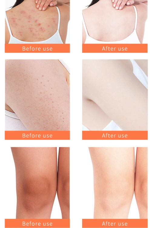 Turmeric Body Scrub